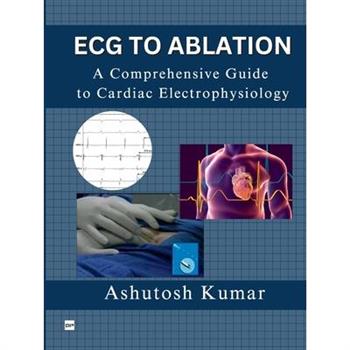 ECG to Ablation